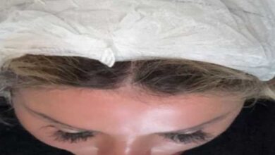 بعد إصابة رزان المغربي.. هل تتحول قاعات الحفلات إلى قنابل موقوتة؟