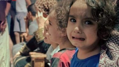 ماذا يقول العالم عن الموت جوعا في غزة؟