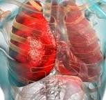 الالتهاب الرئوى