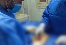 فريق طبي بمستشفى مطاي المركزي ينقذ مريضاً من تسمم دموي ويجري 11 جراحة متنوعة